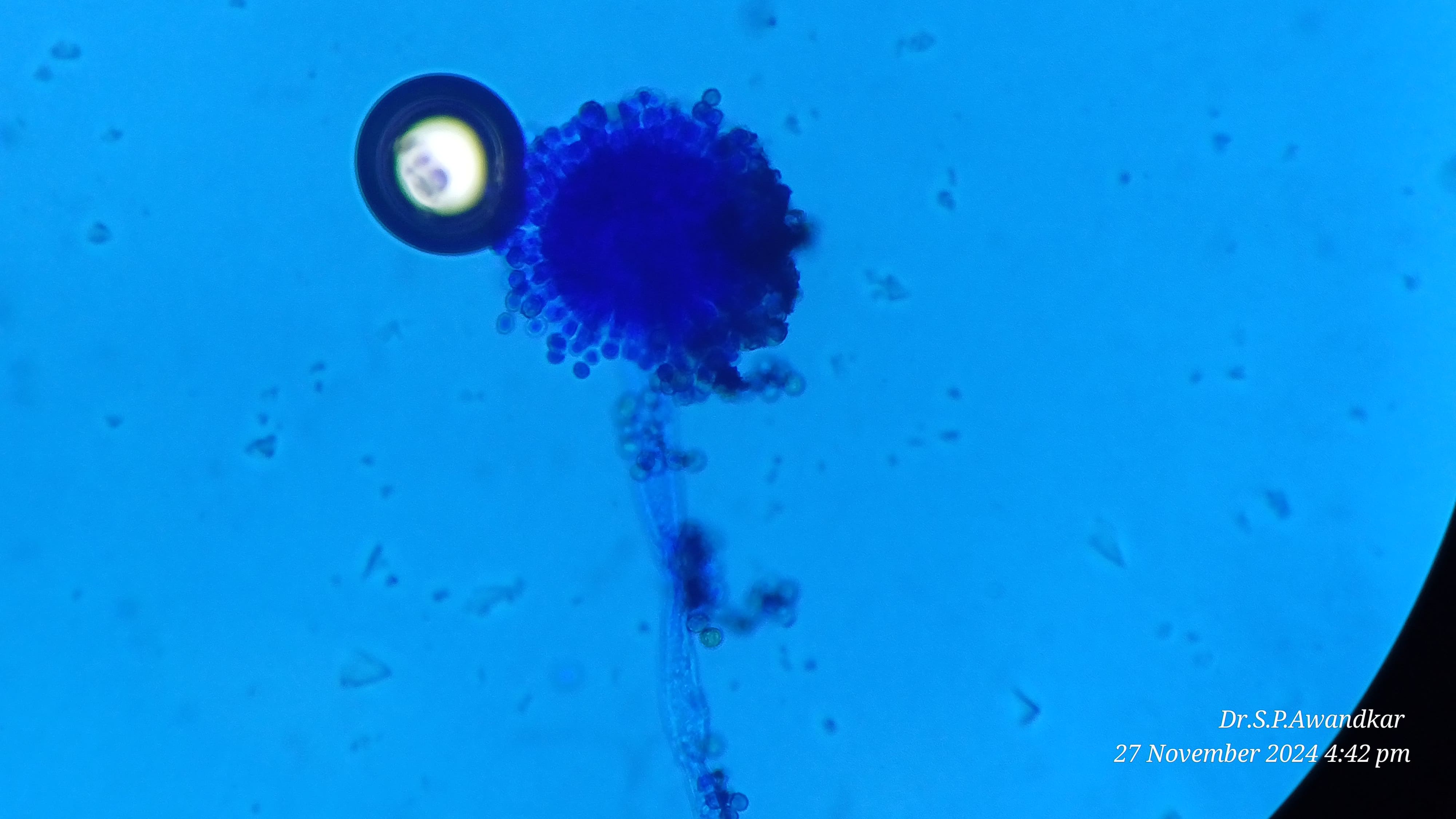 37. Aspergillus Flavus Microscopic